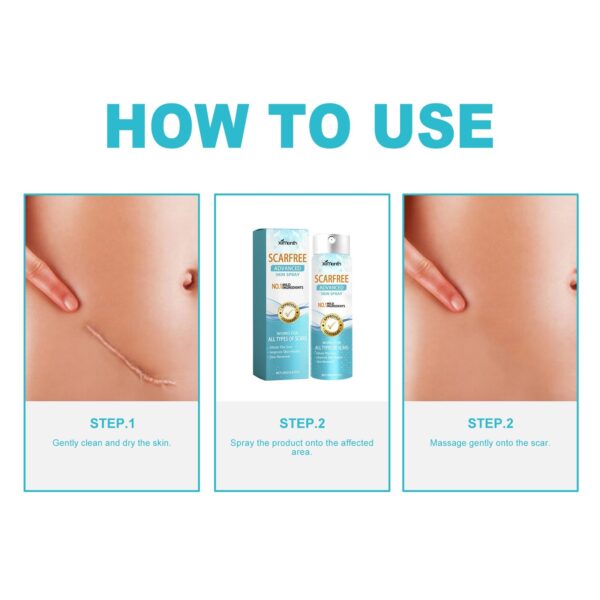 Lighten Scar Care Spray On Body Skin /Spray aclarador para cicatrices en la piel del cuerpo - Imagen 7