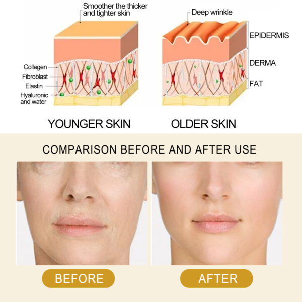 EELHOE Collagen Essence Improves Facial Skin, Lightens Fine Lines, Hydrates And Firms The Skin / La esencia de colágeno EELHOE mejora la piel del rostro, aclara las líneas finas, hidrata y reafirma la piel. - Imagen 2
