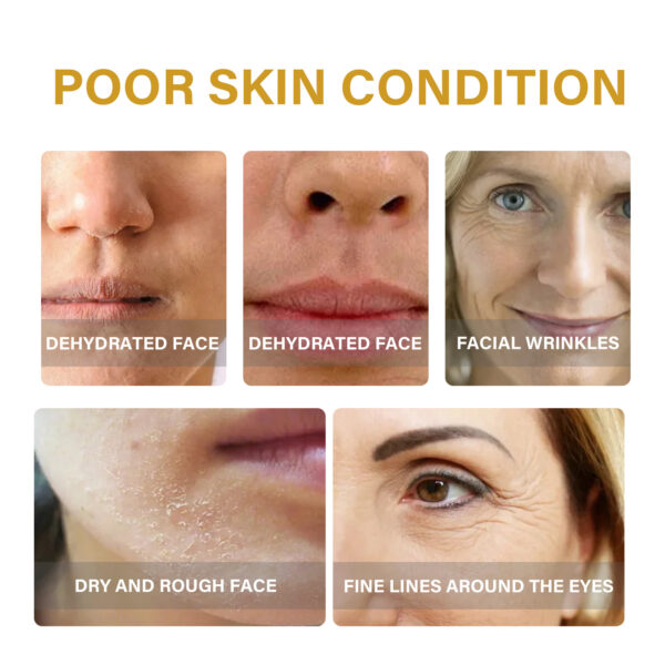 EELHOE Collagen Essence Improves Facial Skin, Lightens Fine Lines, Hydrates And Firms The Skin / La esencia de colágeno EELHOE mejora la piel del rostro, aclara las líneas finas, hidrata y reafirma la piel. - Imagen 4