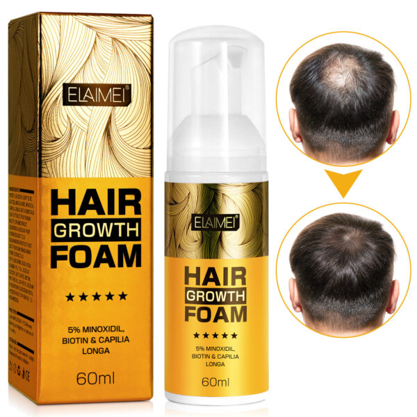 Mousse Fortalecedor con Minoxidil, Cúrcuma y Biotina – Crecimiento y Anticaída / Hair Growth & Thickening Mousse with Minoxidil, Turmeric & Biotin - Imagen 5