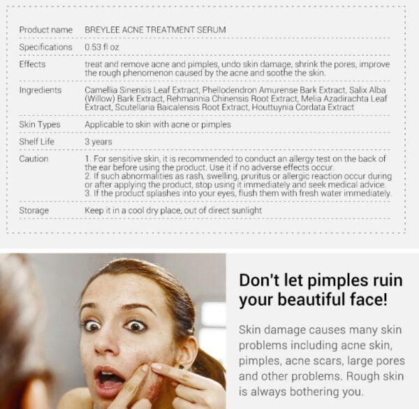 Suero para el tratamiento del acné, aceite reparador facial / Acne Treatment Serum Facial Repair Oil - Imagen 3