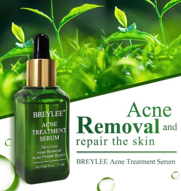 Suero para el tratamiento del acné, aceite reparador facial / Acne Treatment Serum Facial Repair Oil - Imagen 5