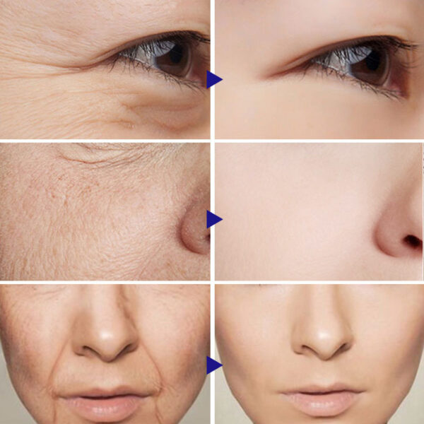 Vitamin C Serum Facial Serum - Imagen 5