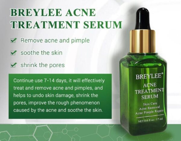 Suero para el tratamiento del acné, aceite reparador facial / Acne Treatment Serum Facial Repair Oil - Imagen 6
