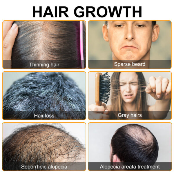 Mousse Fortalecedor con Minoxidil, Cúrcuma y Biotina – Crecimiento y Anticaída / Hair Growth & Thickening Mousse with Minoxidil, Turmeric & Biotin - Imagen 4